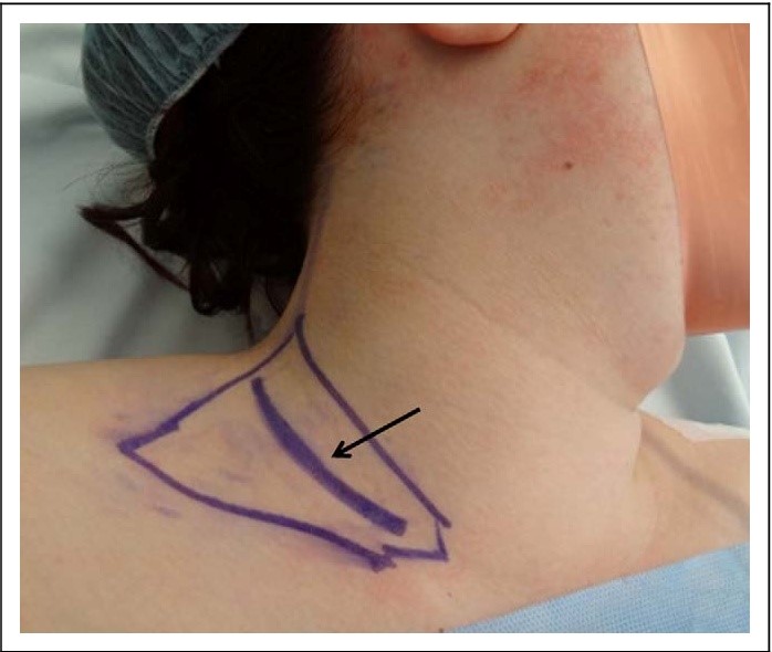 نمونه اعمال جراحی