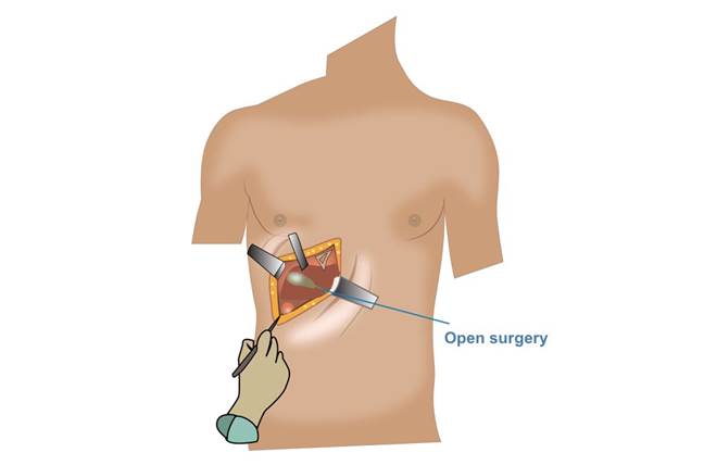 https://www.thesurgeonscollective.com.au/wp-content/uploads/2018/07/BRON-open-surgery-perth.jpg