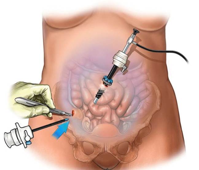 https://drjagangastrocare.com/wp-content/uploads/2023/06/Untitled-design-3-compressed-1-1.jpg
