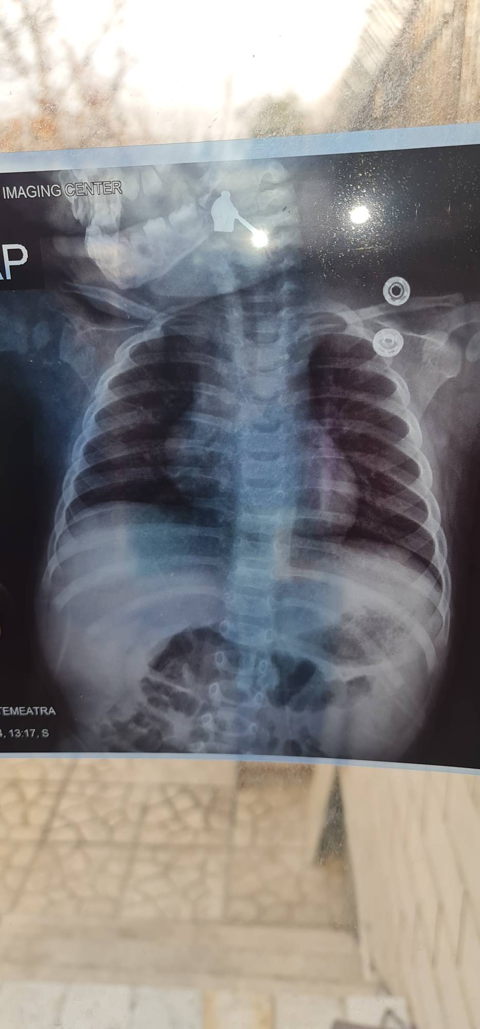 میاستنی گراویس MG