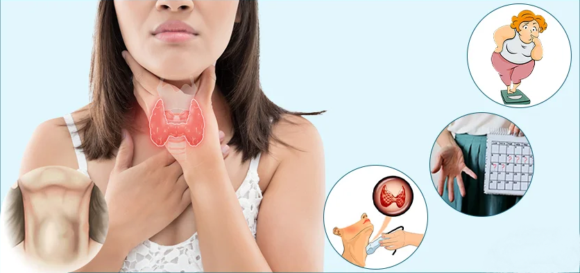 مشکلات تیروئید در زنان