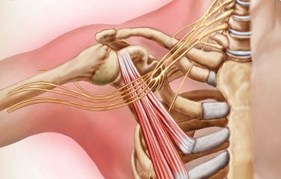 عمل جراحی درمان سندرم توراسیک اوت لت