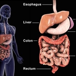 عمل جراحی کولیت اولسراتیو (کولیت زخمی)