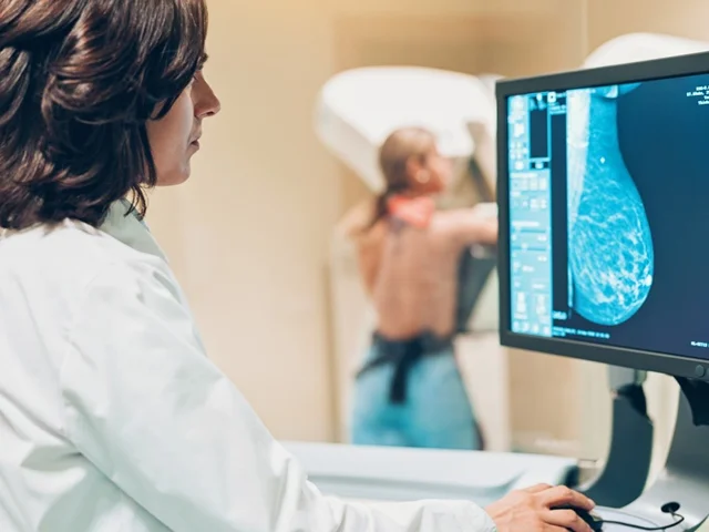 تحقیقات جدید در مورد سن شروع ماموگرافی برای تشخیص سرطان پستان