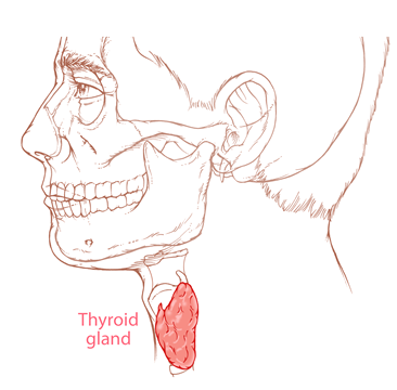 سوالات متداول در مورد سرطان تیروئید