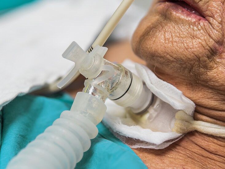 جراحی نای: نای شکافی یا تراکئوستومی