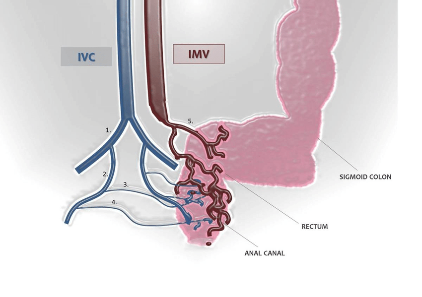 سوالات متداول در مورد واریس رکتوم  (Rectal Varices)