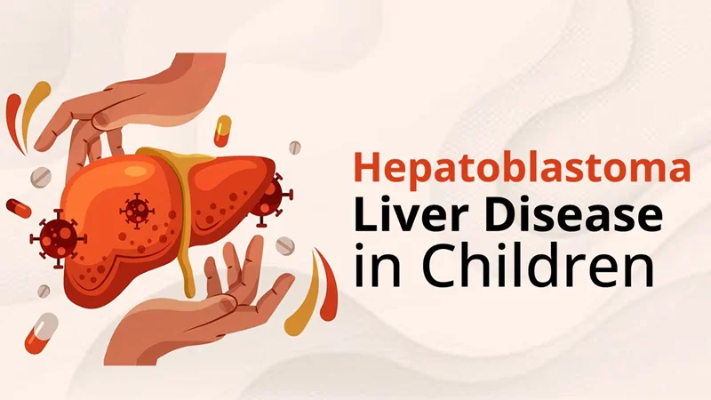 هپاتوبلاستوما (Hepatoblastoma)